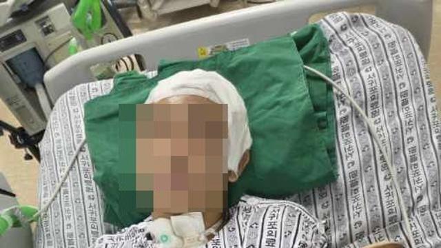 복싱대회서 의식 불명까지... 도대체 어느 정도였길래