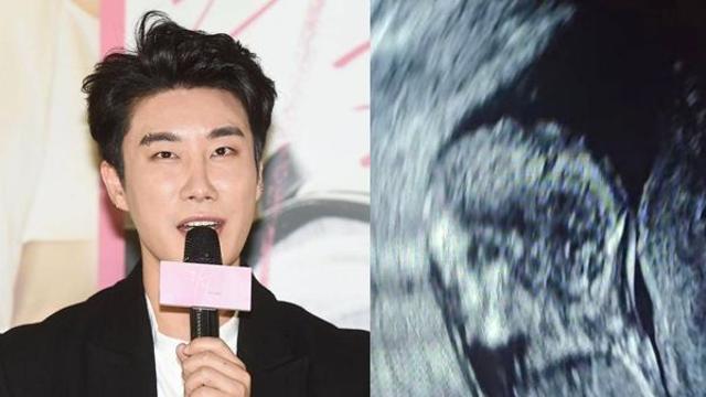 '행인 폭행→기소유예' 산이, 겹경사 알렸다 