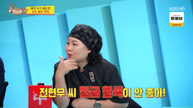 '사당귀' 박명수, 얼굴 부상 전현무에 