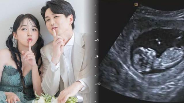 근친설 비웃듯…40세에 ‘기적 임신’ 강은비, 