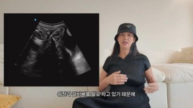 '송재희♥' 지소연, 이란성 쌍둥이 품기 쉽지 않네 
