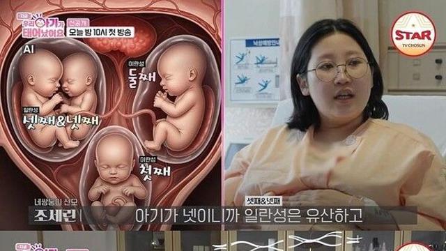 네쌍둥이 산모, '선택 유산' 권유 받았다 