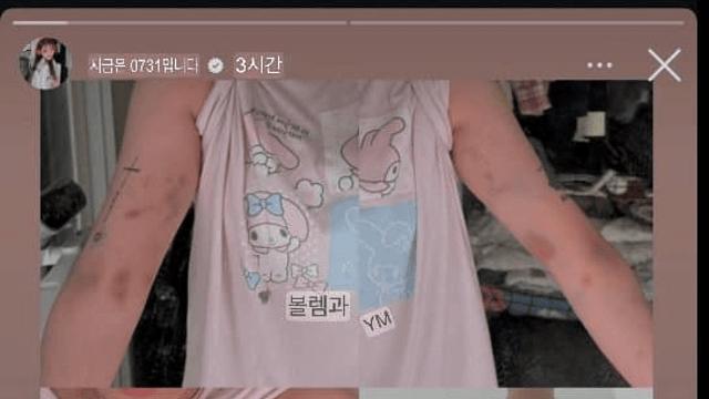 홍대에서 맞은 대만 여자.....댓글 반응.....JPG