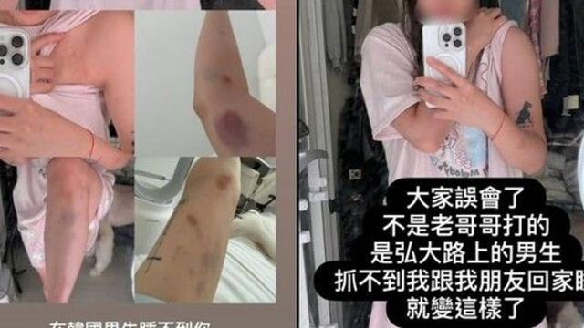 '대만 유튜버 폭행' 가해자는 한국남성…경찰 
