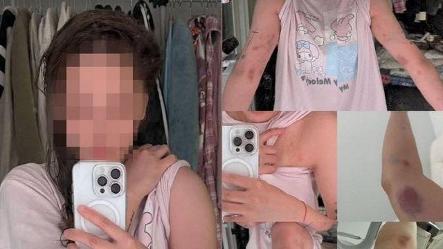 홍대서 '하룻밤' 거절한 대만 유튜버 폭행, 알고보니 중국 남성