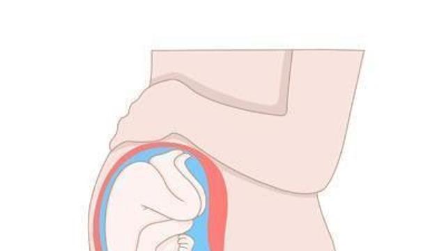 조산 방지 주사, 10월부터 건보 적용 '최대 4회'