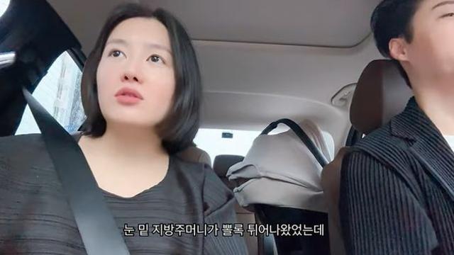 '85kg→59kg 감량' 이수민, 충격적인 노화 고백 