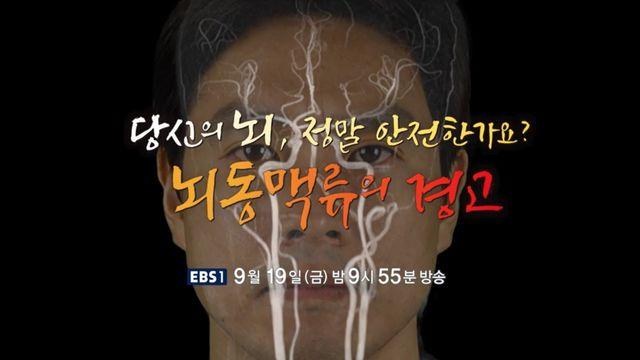 EBS 명의, '당신의 뇌, 정말 안전한가요? 뇌동맥류의 경고' 편