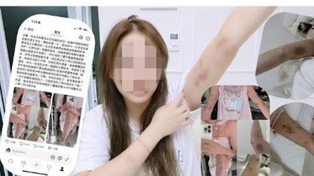 “홍대서 한국 남성이 폭행”…대만 女유튜버, 당시 상황 들어보니