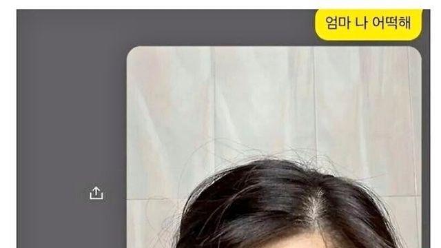 심심해서 이마에 부항 떠 본 여자