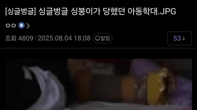 똥싸거나 목욕할 때마다 눈물난다는 디씨인 