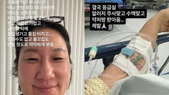 김영희 “처음 겪는 고통”…얼굴 몰라볼 정도로 부었다 [RE:스타]