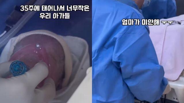 ‘응급 출산’ 김지혜, 숨 쉬기 힘든 상태… “엄마가 미안해” [RE:스타]