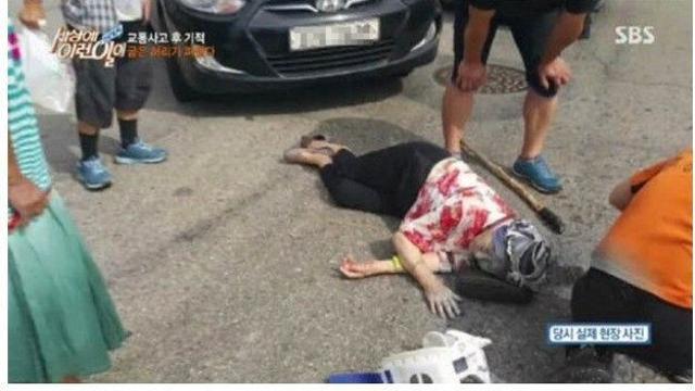 비상식적인 자동차 물리치료 레전드