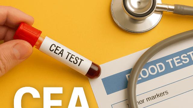 암표지자 검사 CEA 정상수치 꼭 확인해야 하는 이유와 관리법