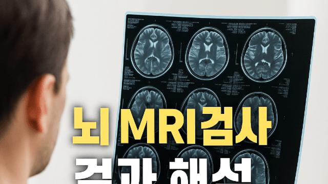 뇌 MRI 검사 결과 해석 쉽게 이해하는 방법 정리해드립니다