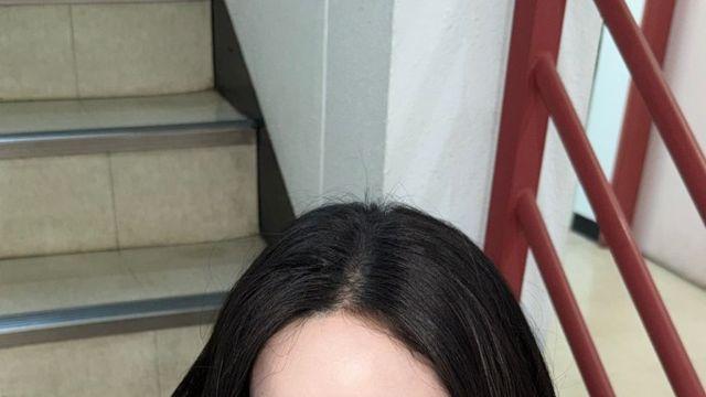 말라리아 걸렸었다는 아이돌
