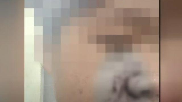 학폭 막아선 의인 전치 2주...