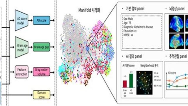 한국인 치매코호트로 만든 개방형 플랫폼, AI 조기예측 시스템 개발