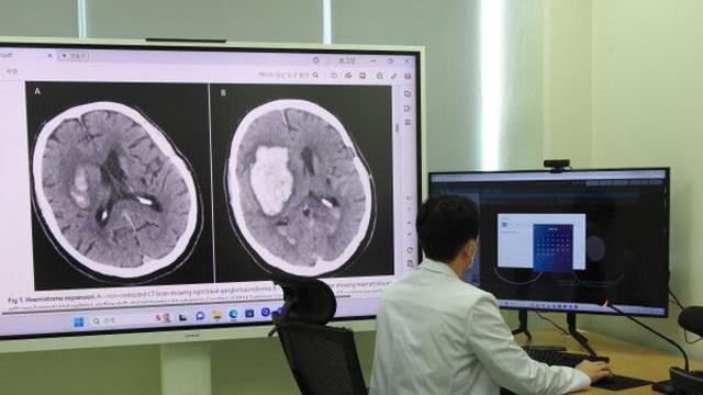 전문의 부족한 강원도…AI가 '뇌출혈 골든 타임' 지킨다[빠정예진]