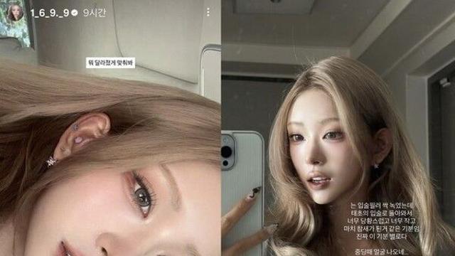 최준희, 눈·윤곽 성형 후 입술 필러 녹여…달라진 외모