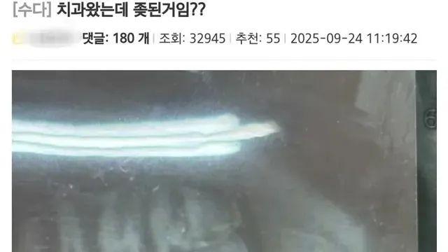 치과왔는데 사랑니 이거 ㅈ된거임?,,