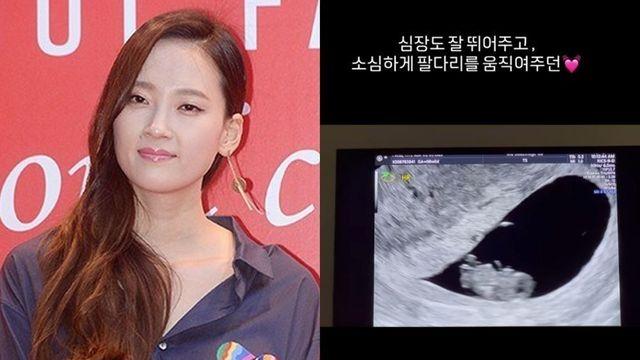 “두 번의 아픔 겪어”…혜박, 17년 만에 둘째 임신 [RE:스타]