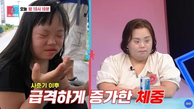 '다운증후군' 정은혜, 몸무게 악플 심각…母 