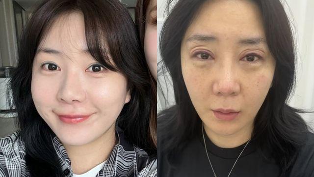 ‘성형 부작용’ 허안나, 코→눈까지 건드렸다…”보기만 해도 아파” [RE:스타]