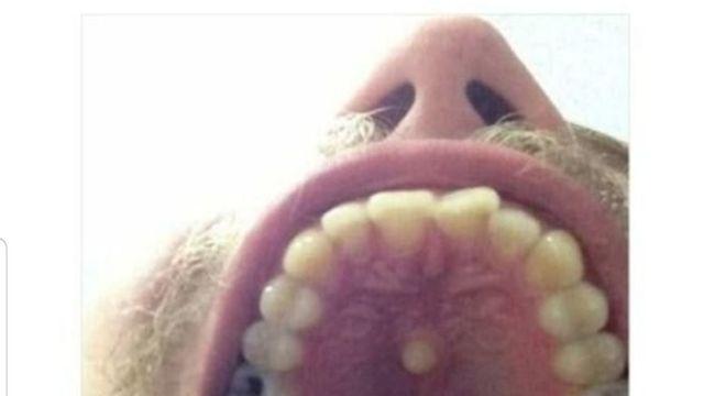 치과에서도 놀란 역대급 치아 위치