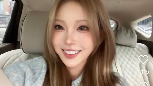 최준희, 입술 필러 녹이고 달라진 외모…더 예뻐져