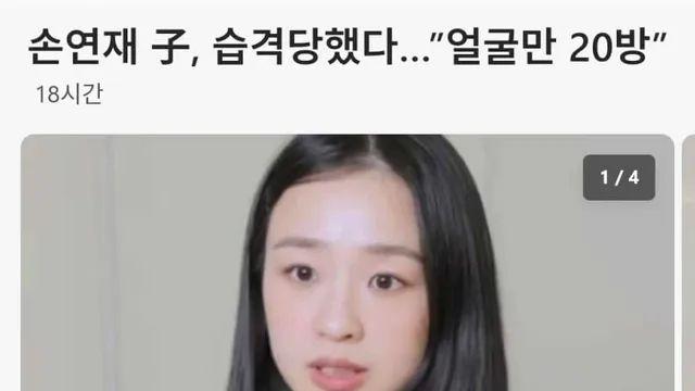 손연재 子, 습격당했다... 