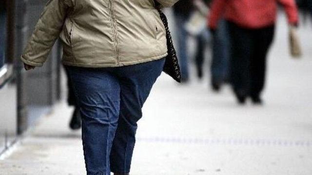 이탈리아, 세계 최초로 비만을 ‘만성 질환’으로 공식 분류