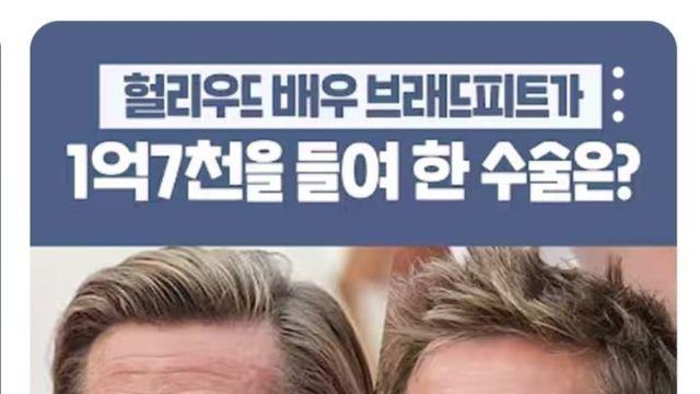 브래드 피트가 받았던 2억원짜리 성형수술