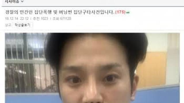 깜짝깜짝 버닝썬 게이트....폭행 피해자 근황....JPG