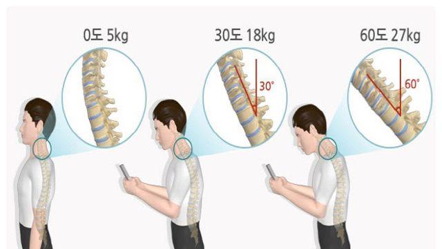 스마트폰과 함께 고개 숙인 당신, 거북목증후군 부른다