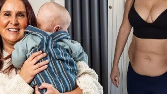 복부 성형 수술 후 임신 사실 알게 된 女…