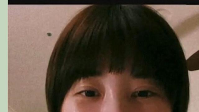 서인영 최근 얼굴 상태 ㄷㄷ