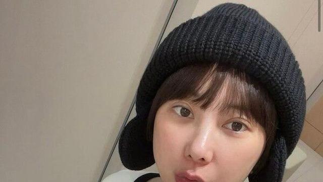 '10㎏ 증가' 서인영, 성형 부작용 고백 