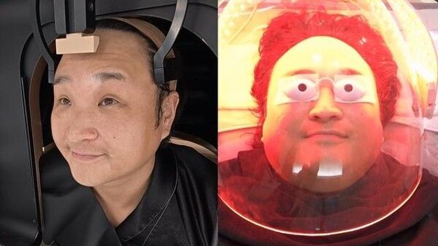 구성환, 난치성 질환 '백반증' 치료 시작…예상치 못한 '이것' 충격 ('나 혼자 산다')