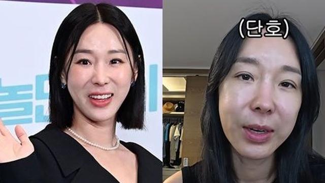 이지혜, 성형 끊었다고 선언했지만 