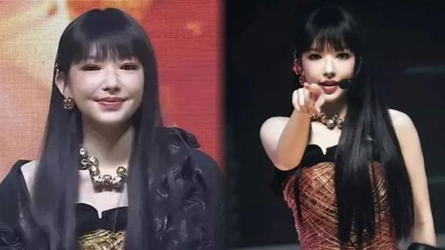 '우주소녀' 성소, 중국서 퉁퉁 부은 얼굴....