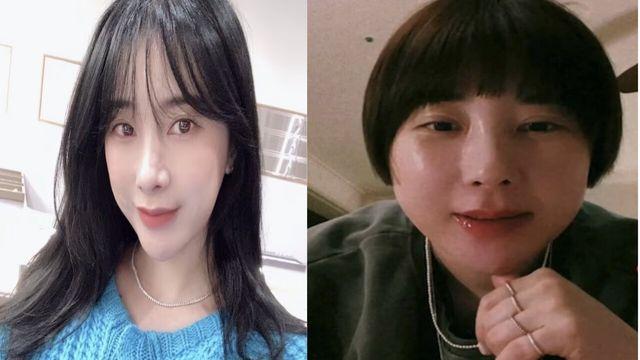 서인영 “코 다 뺐다”…성형 부작용 고백 10kg 체중 증가 충격 근황