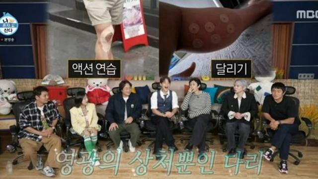 구성환, 액션 연습하다 무릎 부상 “현재 재활 중” (나혼산)