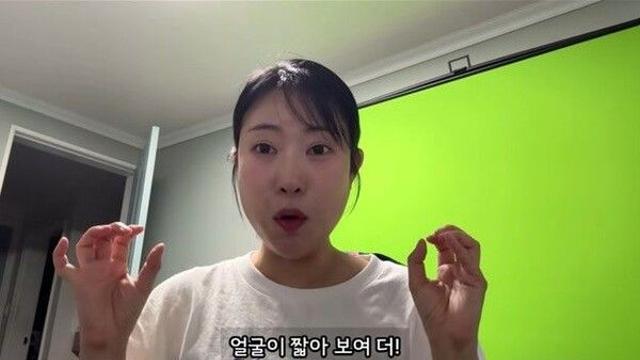 '성형비 1억 5천' 이세영, 귀 필러 후 감탄 