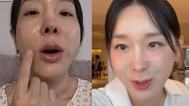 이지혜, 입술 문신 후 헤르페스로 고생 