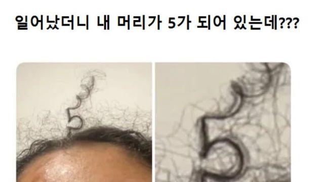 일어나보니 머리가 5가 됐다