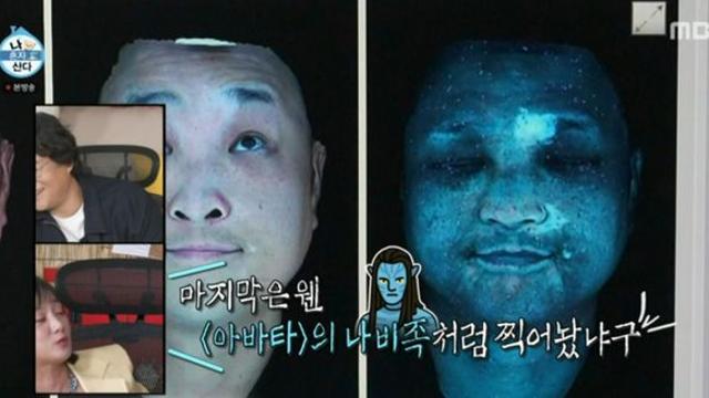 ‘백반증’ 구성환, 심각한 피부 상태 “털도 하얗게 변해” (나혼산)