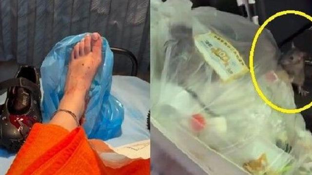 신주쿠 한복판서 쥐에 공격당한 女…