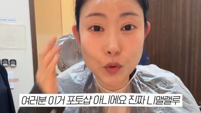 ‘E컵 성형’ 이세영 얼굴을 또…“진짜 신기하다” 뜨거운 반응